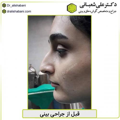 جراحی-بینی-450