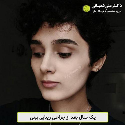 جراحی-بینی-454