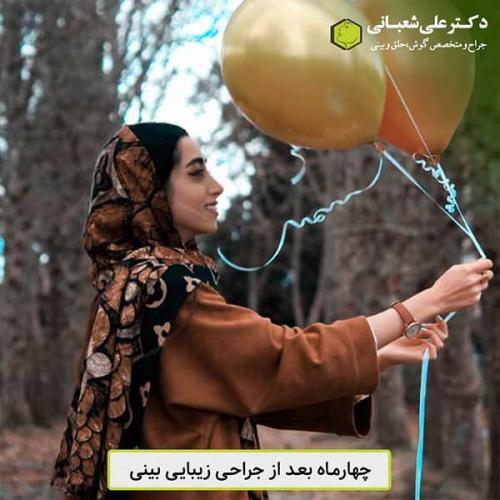 جراحی-بینی-458
