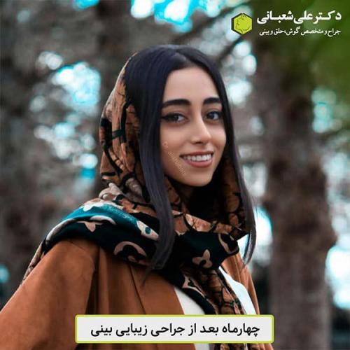 جراحی-بینی-460