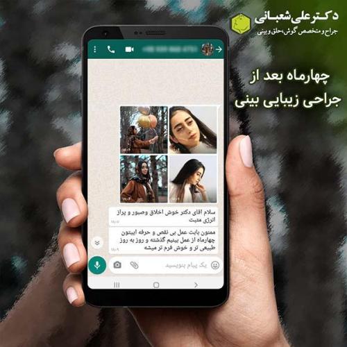 جراحی-بینی-461