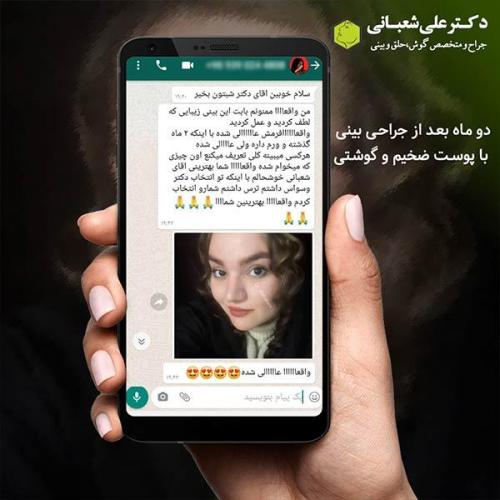 جراحی-بینی-464