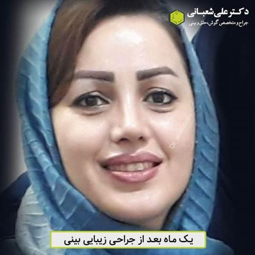 جراحی-بینی-470