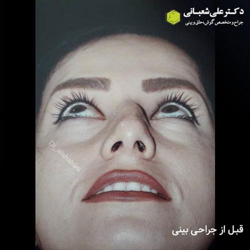 جراحی-بینی-486