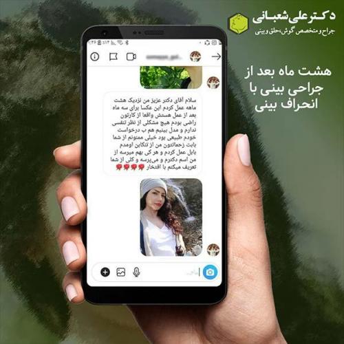جراحی-بینی-487