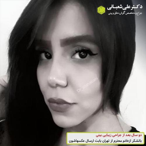 جراحی-بینی-488