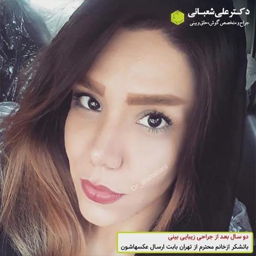 جراحی-بینی-489