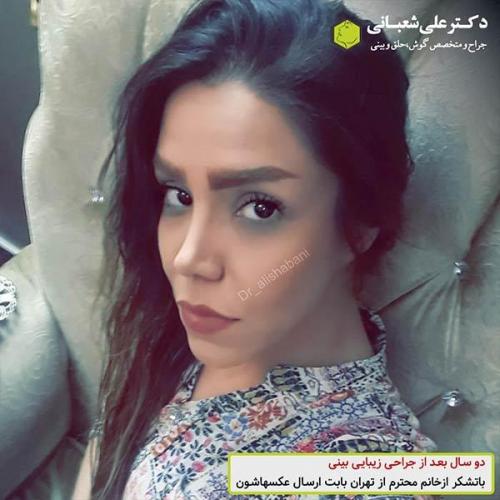 جراحی-بینی-490