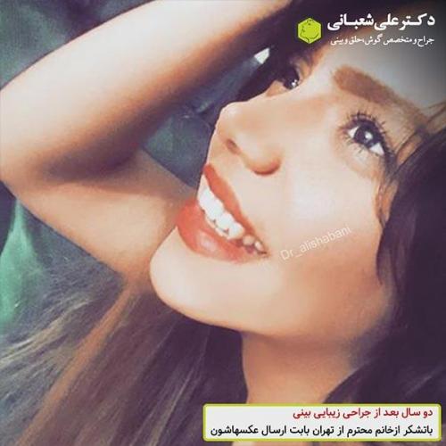 جراحی-بینی-492