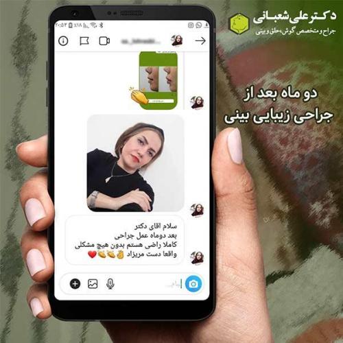 جراحی-بینی-508