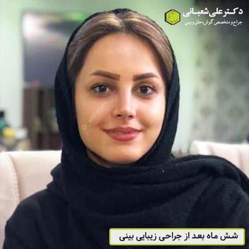 جراحی-بینی-514