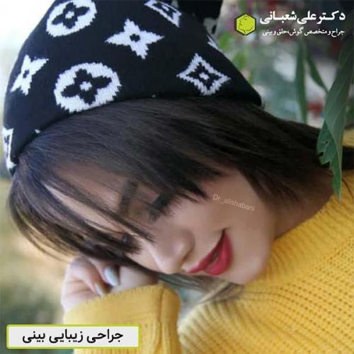 جراحی-بینی-532