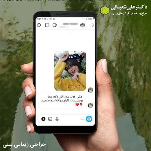 جراحی-بینی-533