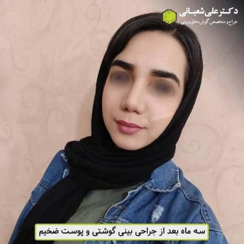 جراحی بینی 600 (10)