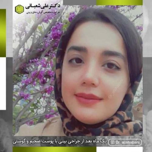 جراحی بینی 600 (113)