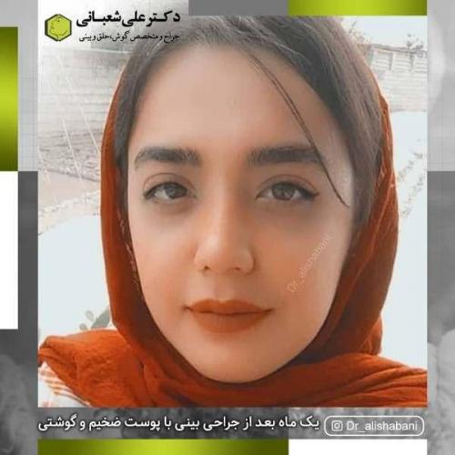 جراحی بینی 600 (115)