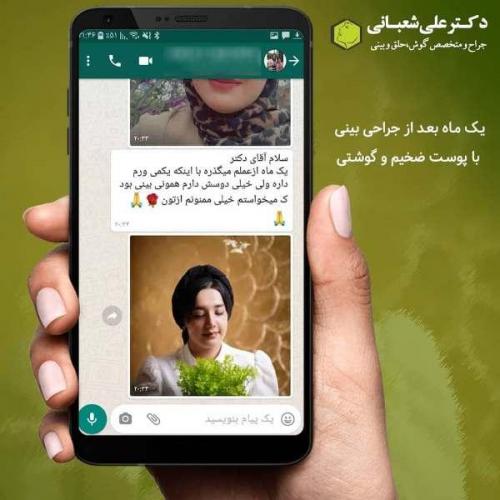 جراحی بینی 600 (116)