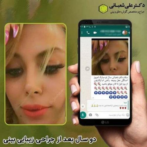 جراحی بینی 600 (117)