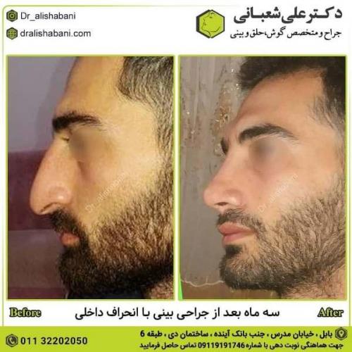 جراحی بینی 600 (118)