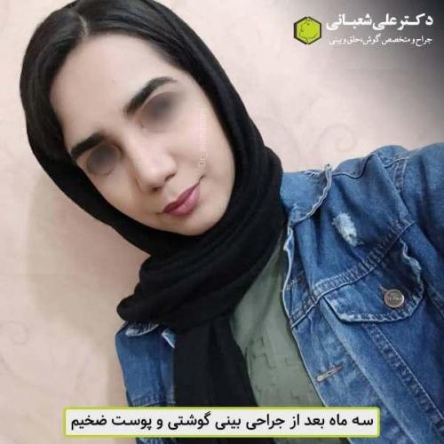 جراحی بینی 600 (5)