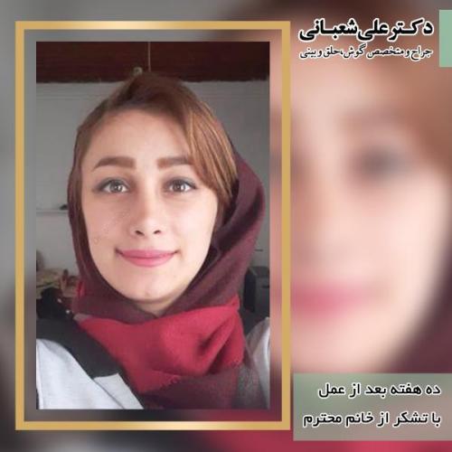 جراحی-بینی-104