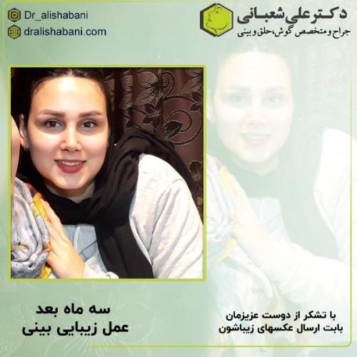 جراحی-بینی-129