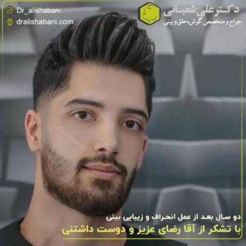 جراحی-بینی-172