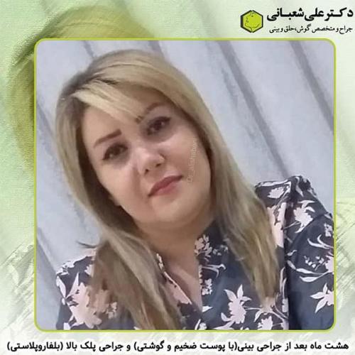 جراحی-بینی-225