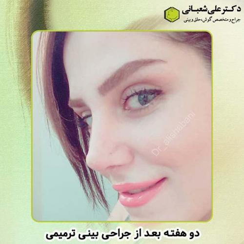 جراحی-بینی-247