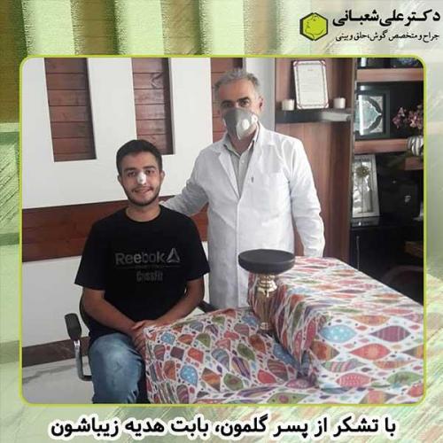 جراحی-بینی-253