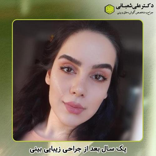 جراحی-بینی-263