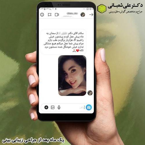جراحی-بینی-344