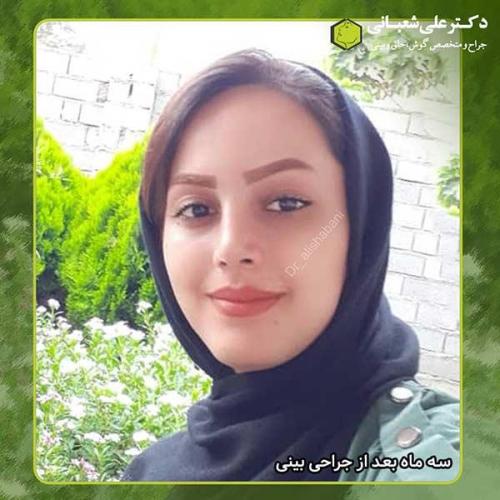 جراحی-بینی-350