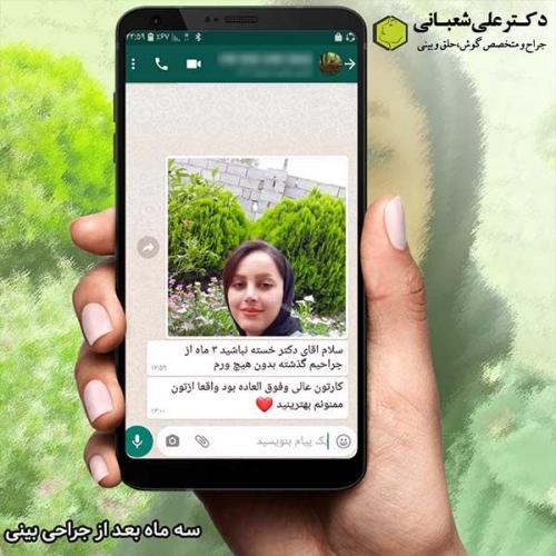 جراحی-بینی-351