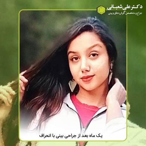 جراحی-بینی-395
