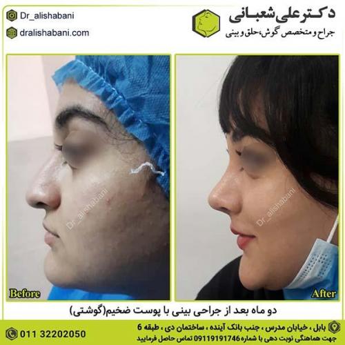 جراحی-بینی-400