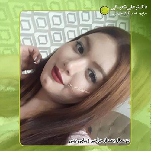 جراحی-بینی-404