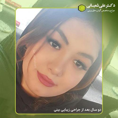 جراحی-بینی-406