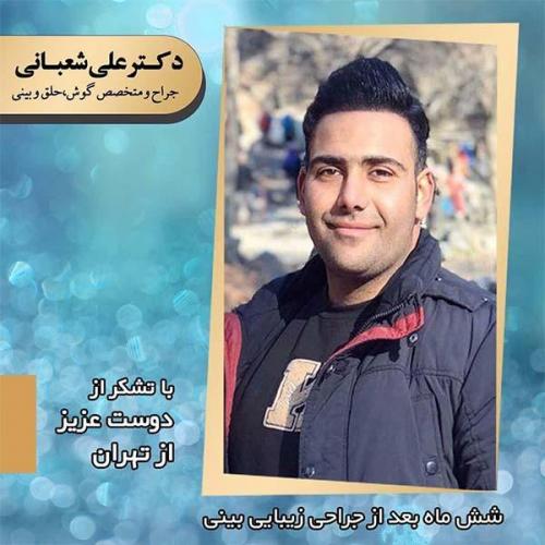 جراحی-بینی-93