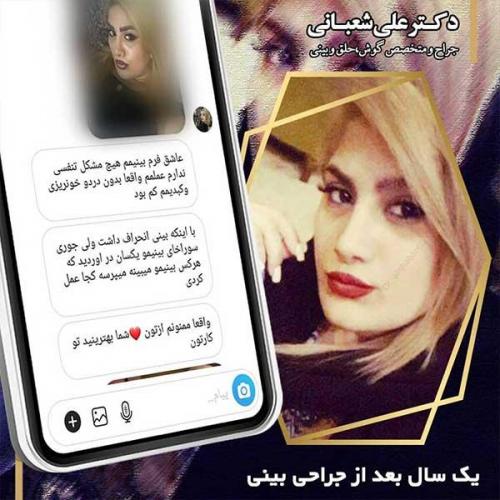 جراحی-بینی-94