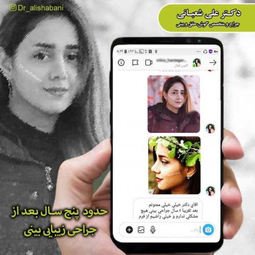 جراحی بینی 101