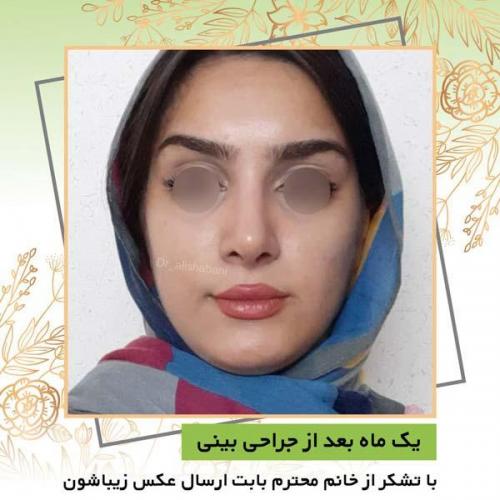 جراحی بینی 20