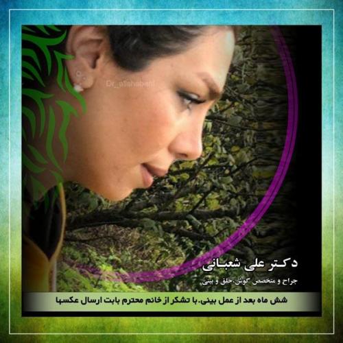 جراحی بینی 6