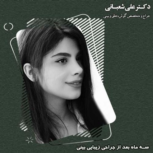 جراحی بینی 67