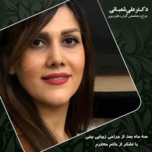 جراحی بینی 72