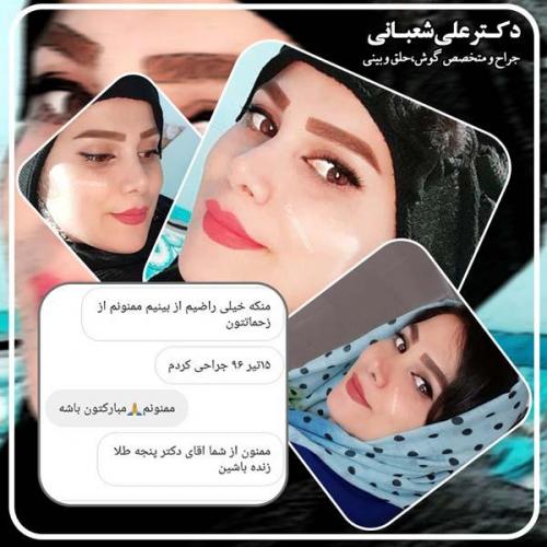 جراحی بینی 77