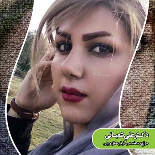 جراحی بینی 78