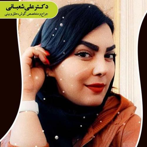 جراحی بینی 81