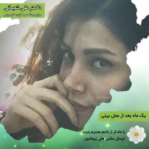 جراحی بینی 89