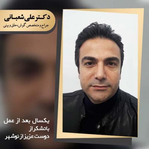 جراحی بینی 98